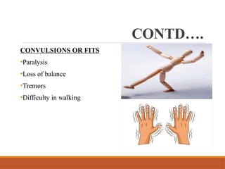 CONTD….
CONVULSIONS OR FITS
•Paralysis
•Loss of balance
•Tremors
•Difficulty in walking
 