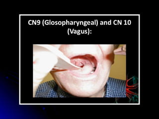 Mental status examination