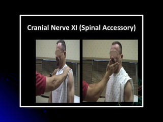 Mental status examination