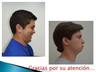 Gracias por su atención…
 