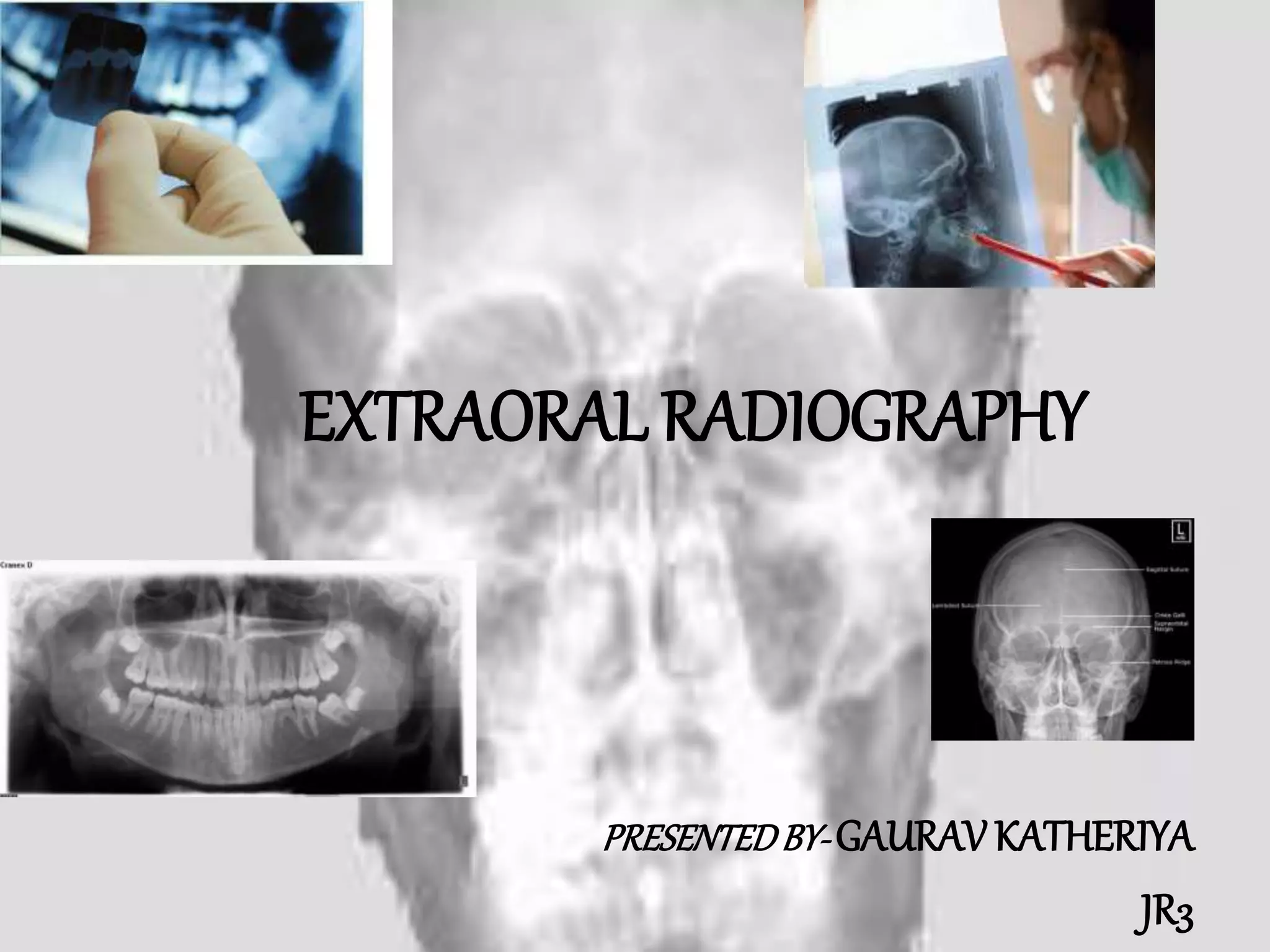 landmarks and interpretation in extraoral radiography PPT