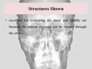 Perous Pyramed landmarks and interpretation in extraoral radiography | PPTX
