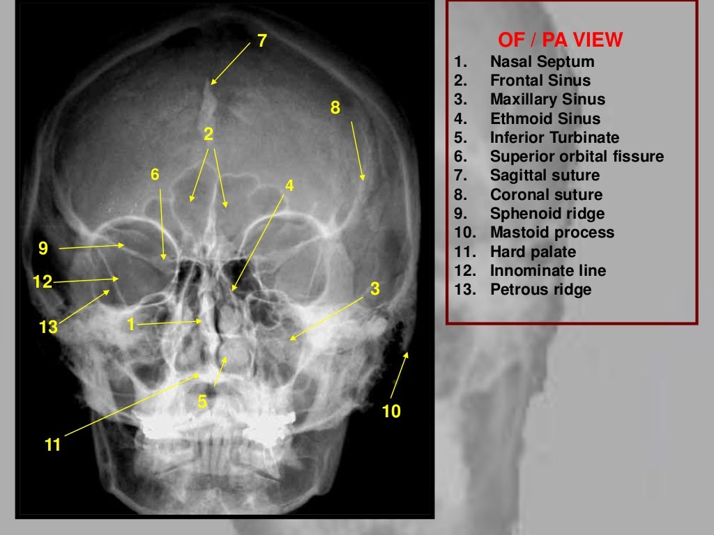 landmarks and interpretation in extraoral radiography