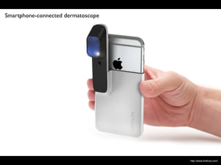 http://www.ﬁrsthud.com/
Smartphone-connected dermatoscope
 