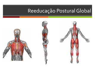 Reeducação Postural Global




(Pawlina, Olson, 1997 baseado em
 Souchard, 1998; Marques, 2000;
       Santos, 2002; Paiva, 2003)
 
