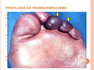 Ocorrem em frequência maior que 5 por minuto