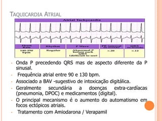 Fibrilação atrial> Frequência 0,4 – 1% populaçãoPrevalência aumenta com a idade- 10% > 80 anos.Etiologia:-Estress emocional                  - Post cirurgica-Hipoxia                                   - Hipercapnia-Hipertireoidimo                      - Valvulopatia mitral-Cardiopatia hipertensiva       - DPOC- Intoxicação alcoolica aguda-Alterações metabólicas ou hemodinamicasECG: ritmo irregular, ausência de onda P ondas f fibrilatórias.FC: 120-180 bpm