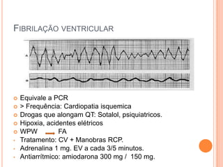 CONTROLE DA FREQUENCIA CARDÍACAFA crônica 