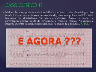 Differentialdiagnosis / DefibrillationRITMO “CHOCÁVEL***” OU NÃO ?*** CHOCÁVEL = Fibrilação ventricular ou Taquicardia ventricular sem pulso !