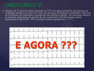CASO CLÍNICO IVMulher de 96 anos de idade, admitida há 30 minutos no CTI  devido desnutrição, desidratação (+++/4+), portadora de demência avançada. Encontra-se cianótica, com pupilas midriáticas e não-fotorreagentes.... O ECG:E AGORA ???