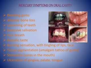  Bleeding gums
 Alveolar bone loss
 Loosening of teeth
 Excessive salivation
 Foul breath
 Metallic taste
 Burning sensation, with tingling of lips, face
 Tissue pigmentation (amalgam tattoo of gums)
 Stomatitis (sores in the mouth)
 Ulceration of gingiva, palate, tongue
 