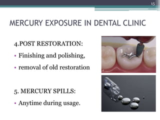 4.POST RESTORATION:
• Finishing and polishing,
• removal of old restoration
5. MERCURY SPILLS:
• Anytime during usage.
15
MERCURY EXPOSURE IN DENTAL CLINIC
 