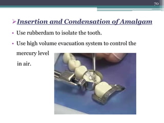 Insertion and Condensation of Amalgam
• Use rubberdam to isolate the tooth.
• Use high volume evacuation system to control the
mercury level
in air.
70
 