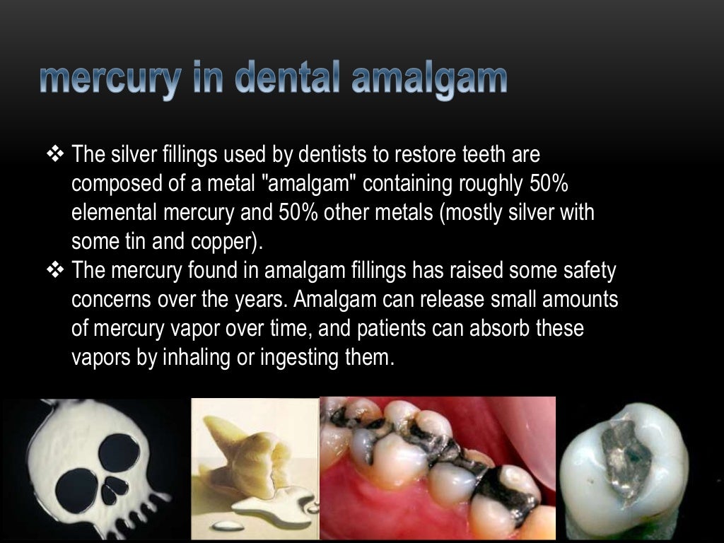 Mercury poisoning & dental amalgam