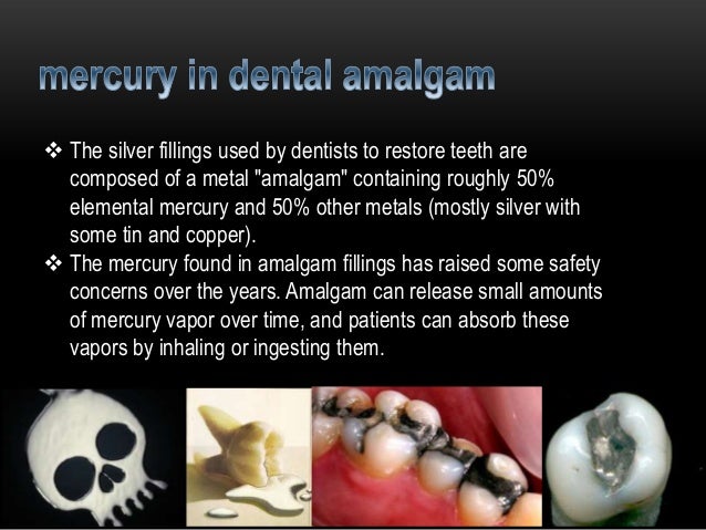 amalgam in restoring teeth essay amalgam in restoring teeth essay