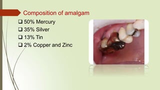 MERCURY TOXICITY.pptx