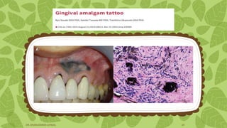 DR. DHANASHREE GUNJAL 20
 