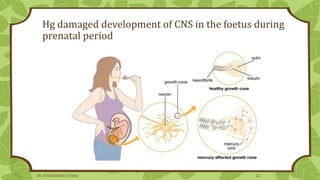 Hg damaged development of CNS in the foetus during
prenatal period
DR. DHANASHREE GUNJAL 22
 
