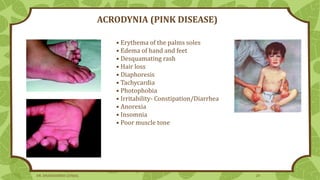 • Erythema of the palms soles
• Edema of hand and feet
• Desquamating rash
• Hair loss
• Diaphoresis
• Tachycardia
• Photophobia
• Irritability- Constipation/Diarrhea
• Anorexia
• Insomnia
• Poor muscle tone
ACRODYNIA (PINK DISEASE)
DR. DHANASHREE GUNJAL 24
 