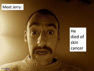 Meet Jerry: He died of skin cancer  Photo: goldberg 