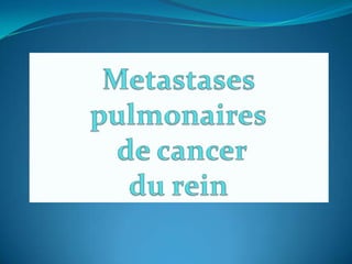 Metastases pulmonaires de cancer du rein 