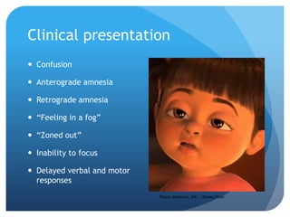TBI and Memory Loss | PPT