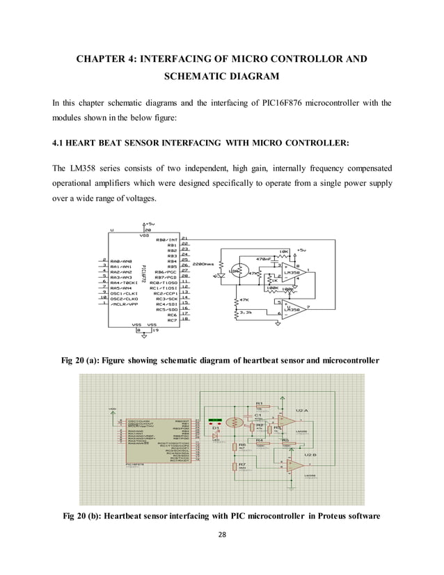 REAL TIME HEART BEAT MONITORING SYSTEM USING PIC16F876 MICROCONTROLLER