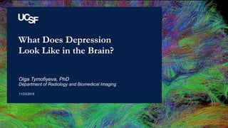 What Does Depression
Look Like in the Brain?
11/23/2015
Olga Tymofiyeva, PhD
Department of Radiology and Biomedical Imaging
 