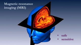 Brain ImagingMagnetic resonance
imaging (MRI)
• safe
• sensitive
 