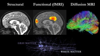Structural Functional (fMRI) Diffusion MRI
GRAY MATTER
WHITE MATTER
 