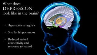 What does
DEPRESSION
look like in the brain?
• Hyperactive amygdala
• Smaller hippocampus
• Reduced striatal
connectivity and
response to reward
 