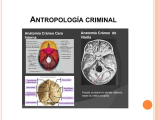 ANTROPOLOGÍA CRIMINAL
 