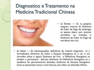 Diagnostico eTratamento na
MedicinaTradicional Chinesa
• d) Lábios — Se esbranquiçados, deficiência do sistema sanguíneo; se a
vermelhados, Síndrome do Calor e Excesso Energético, se a cor é um
vermelho tênue e opaco, Síndrome do Frio e Deficiência Energética, se
tendem a permanecer abertos, Síndrome de Deficiência Energética; se a
tendência for permanecerem fechados, Síndrome de Excesso Energético.
Caso se apresentem secos e com fissuras, isso indica um distúrbio hídrico.
• e) Dentes — Se as gengivas
sangram, trata-se da Síndrome
do Calor de Fogo do estômago;
se apenas doem, sem estarem
vermelhas ou inchadas, é
Síndrome do Calor de Fogo do
meridiano dos rins.
 