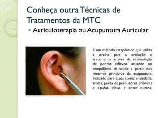 Conheça outra Técnicas de
Tratamentos da MTC
 Auriculoterapia ou Acupuntura Auricular
é um método terapêutico que utiliza
a orelha para a avaliação e
tratamento através da estimulação
de pontos reflexos, atuando no
reequilíbrio da saúde a partir dos
mesmos princípios da acupuntura.
Indicado para casos como: ansiedade,
stress, perda de peso, dores crônicas
e agudas, vícios e entre outros.
 