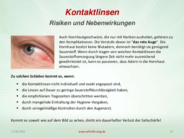 Kontaktlinsen Eine Alternative Zur Brille Oder Dem Augenlasern