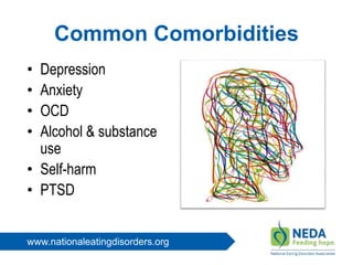 www.nationaleatingdisorders.org
Common Comorbidities
• Depression
• Anxiety
• OCD
• Alcohol & substance
use
• Self-harm
• PTSD
 