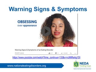www.nationaleatingdisorders.org
Warning Signs & Symptoms
https://www.youtube.com/watch?time_continue=133&v=nJMtReAg1DI
 