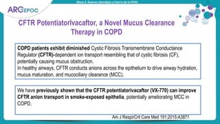 Mesa 4. Nuevos abordajes y futuro de la EPOC
CFTR PotentiatorIvacaftor, a Novel Mucus Clearance
Therapy in COPD
COPD patients exhibit diminished Cystic Fibrosis Transmembrane Conductance
Regulator (CFTR)-dependent ion transport resembling that of cystic fibrosis (CF),
potentially causing mucus obstruction.
In healthy airways, CFTR conducts anions across the epithelium to drive airway hydration,
mucus maturation, and mucociliary clearance (MCC).
Titular tabla
We have previously shown that the CFTR potentiatorivacaftor (VX-770) can improve
CFTR anion transport in smoke-exposed epithelia, potentially ameliorating MCC in
COPD.
Am J RespirCrit Care Med 191;2015:A3871
 