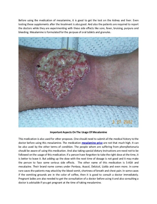 Mesalamine Side Effects Liver