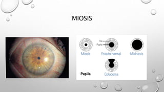 MIOSIS
 