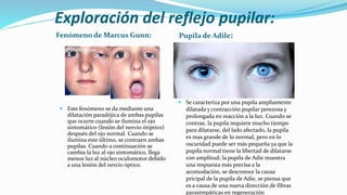 Exploración del reflejo pupilar:
Fenómeno de Marcus Gunn: Pupila de Adile:
 Este fenómeno se da mediante una
dilatación paradójica de ambas pupilas
que ocurre cuando se ilumina el ojo
sintomático (lesión del nervio ótiptico)
después del ojo normal. Cuando se
ilumina este último, se contraen ambas
pupilas. Cuando a continuación se
cambia la luz al ojo sintomático, llega
menos luz al núcleo oculomotor debido
a una lesión del nercio óptico.
 Se caracteriza por una pupila ampliamente
dilatada y contracción pupilar perezosa y
prolongada en reacción a la luz. Cuando se
contrae, la pupila requiere mucho tiempo
para dilatarse, del lado afectado, la pupila
es mas grande de lo normal, pero en lo
oscuridad puede ser más pequeña ya que la
pupila normal tiene la libertad de dilatarse
con amplitud; la pupila de Adie muestra
una respuesta más precisa a la
acomodación, se desconoce la causa
pricipal de la pupila de Adie, se piensa que
es a causa de una nueva dirección de fibras
parasimpáticas en regeneración
 
