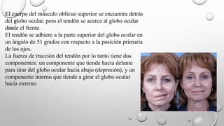 El cuerpo del músculo oblicuo superior se encuentra detrás
del globo ocular, pero el tendón se acerca al globo ocular
desde el frente.
El tendón se adhiere a la parte superior del globo ocular en
un ángulo de 51 grados con respecto a la posición primaria
de los ojos.
La fuerza de tracción del tendón por lo tanto tiene dos
componentes: un componente que tiende hacia delante
para tirar del globo ocular hacia abajo (depresión), y un
componente interno que tiende a girar el globo ocular
hacia externo
 