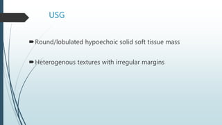 USG
Round/lobulated hypoechoic solid soft tissue mass
Heterogenous textures with irregular margins
 
