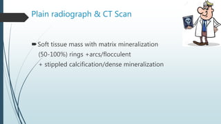 Plain radiograph & CT Scan
Soft tissue mass with matrix mineralization
(50-100%) rings +arcs/flocculent
+ stippled calcification/dense mineralization
 