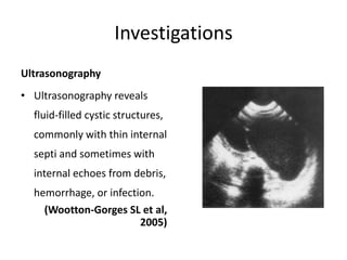 Investigations
Ultrasonography
• Ultrasonography reveals
fluid-filled cystic structures,
commonly with thin internal
septi and sometimes with
internal echoes from debris,
hemorrhage, or infection.
(Wootton-Gorges SL et al,
2005)
 