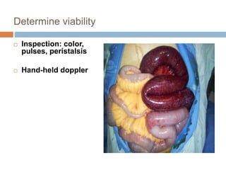 Determine viability
 Inspection: color,
pulses, peristalsis
 Hand-held doppler
 