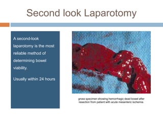 Second look Laparotomy
A second-look
laparotomy is the most
reliable method of
determining bowel
viability.
Usually within 24 hours
gross specimen showing hemorrhagic dead bowel after
resection from patient with acute mesenteric ischemia.
 