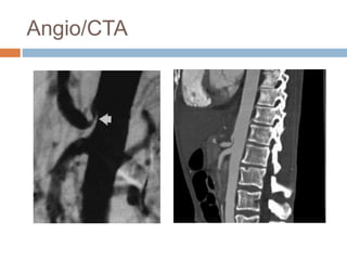 Angio/CTA
 