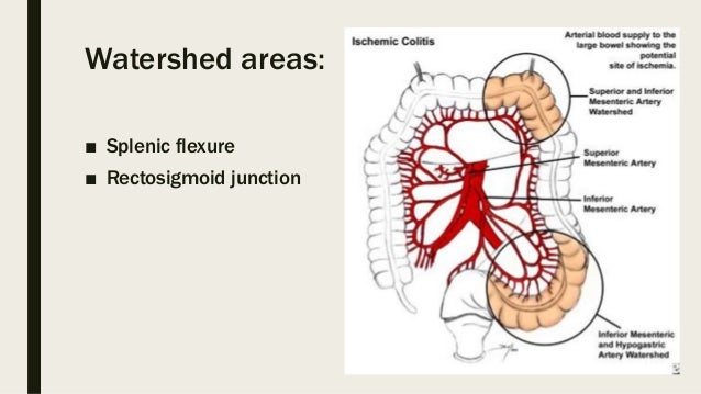 Mesenteric Ischemia Mesenteric Ischemia