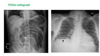 Plain radiograph
 